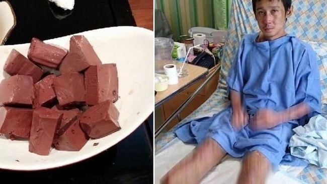 Makanan untuk Turunkan Kolesterol hingga Amputasi Karena Makanan