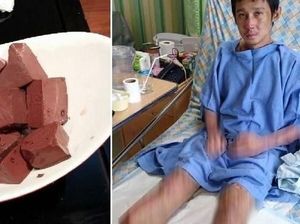 Makanan untuk Turunkan Kolesterol hingga Amputasi Karena Makanan