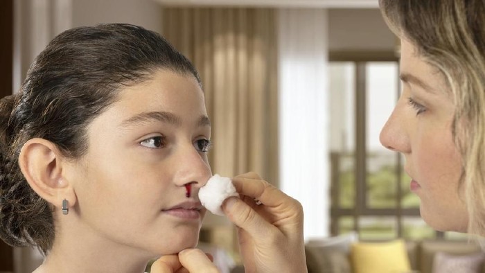 10 Penyebab Mimisan, Mulai Udara Kering Hingga Pilek