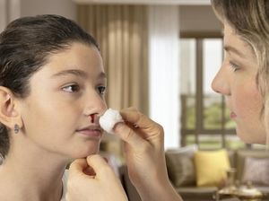 10 Penyebab Mimisan, Mulai Udara Kering Hingga Pilek