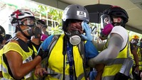 Akibat penembakan tersebut, ia harus menjalani beberapa kali operasi meski akhirnya matanya tidak bisa diselamatkan. Semenjak ia dikeluarkan dari rumah sakit tiga pekan lalu, Veby menuturkan bola matanya yang pecah mungkin bisa diangkat jika kondisinya semakin memburuk. Kini Veby juga mengalami disorientasi terhadap kedalaman. Dia juga merasa bola mata kirinya mudah lelah. Insiden yang menimpa wartawati itu membuat Aliansi Jurnalis Hong Kong (HKJA) menuntut kepala kepolisian setempat terkait dugaan pelanggaran etika yang membatasi pekerjaan wartawan. Vincent Yu/AP Photo.