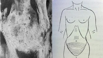 Pada akhir 1890-an, beberapa mumi wanita bertato ditemukan di Mesir. Tato di mumi amunet ini menutupi sebagian besar perut bagian bawah dan tubuhnya. Foto: Tattoo.com