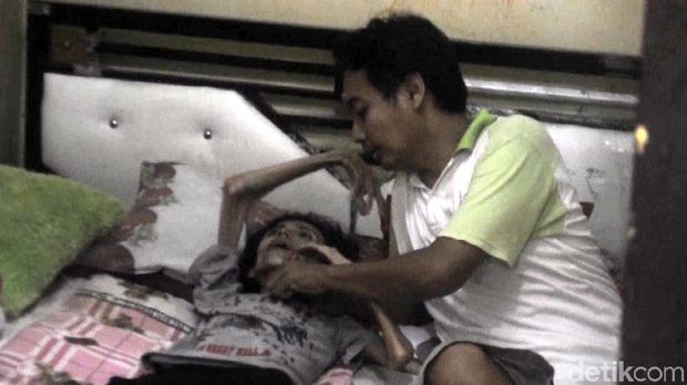 Idap Kanker Paru, Tubuh IRT Sukabumi Ini Kering Kerontang