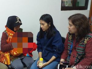 Bayi Pandhu yang Cacat Akan Jalani Rekonstruksi Wajah