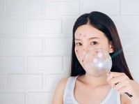Jerawat dan Kulit Kusam Bisa Diatasi dengan Masker Kulit Pisang Ini