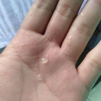 Hujan Es dan Angin Terjadi di Kabupaten Bandung, 3 Pohon Tumbang