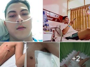 Dulu Tak Percaya Bahaya Rokok, Daus Akhirnya Harus Rasakan Dada Dilubangi