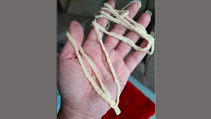 cacing pita cacing pita