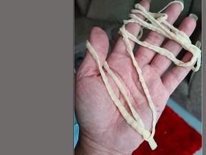 5 Diet Ekstrem yang Nyeleneh, Ada Diet Cacing hingga Diet Kapas