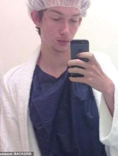 Ekstrem! Transgender Niat Pasang Implan Payudara di Kepala Demi Mirip Boneka