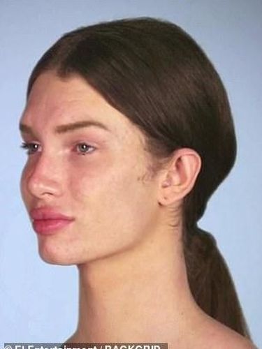 Ekstrem! Transgender Niat Pasang Implan Payudara di Kepala Demi Mirip Boneka