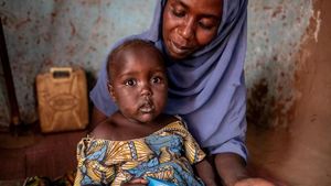 Upaya Mengobati Anak-anak Positif HIV di Uganda