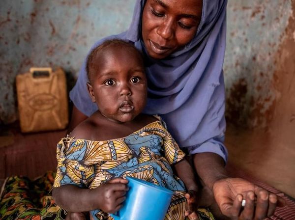 Upaya Mengobati Anak-anak Positif HIV di Uganda