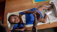 Bayi memerlukan jenis te skhusus untuk penanganan HIV (virologis) yang tidak tersedia di sebagian besa wilayah negara berpenghasilan rendah ini.