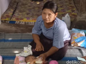 Pak Bupati, Bayi Tanpa Anus di Madiun Ini Tak Punya Biaya untuk Operasi
