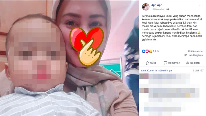 Sang anak dilaporkan sedang dalam masa pemulihan. (Foto: Facebook/Apri Apri) Sang anak dilaporkan sedang dalam masa pemulihan. (Foto: Facebook/Apri Apri)