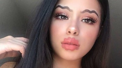 Foto: Penampakan Para Wanita dengan Bibir Keriting yang Lagi Tren