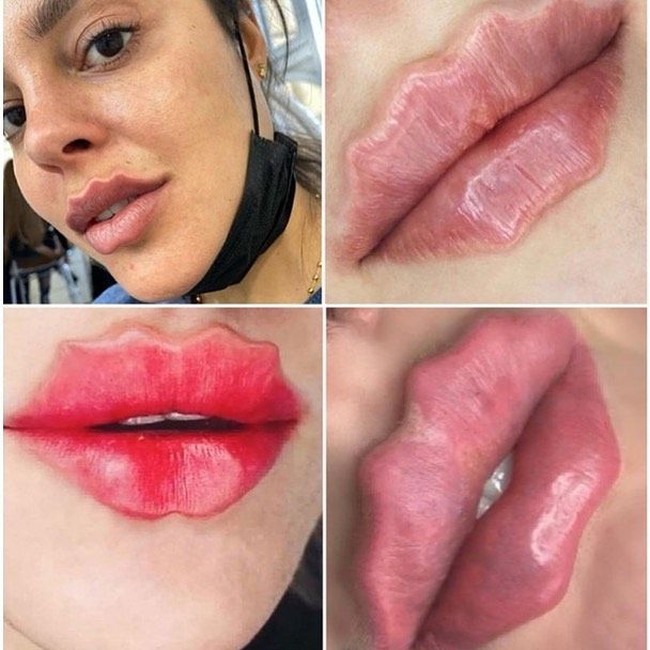 Trend makeup selalu berganti seiring berjalannya waktu. Salah satu yang tengah menjadi tren belakangan ini di Rusia adalah makeup bibir keriting. Tren makeup ini akan membuat bibir terlihat bergelombang. Foto: Instagram skinsential_aesthetics