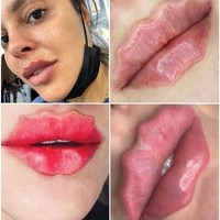 Trend makeup selalu berganti seiring berjalannya waktu. Salah satu yang tengah menjadi tren belakangan ini di Rusia adalah makeup bibir keriting. Tren makeup ini akan membuat bibir terlihat bergelombang. Foto: Instagram skinsential_aesthetics
