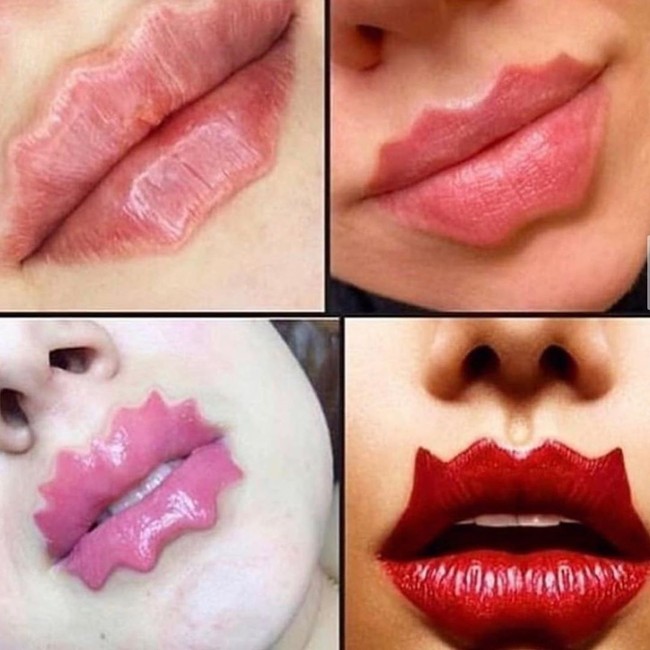 Jika kamu tertarik untuk mencoba mengikutinya, maka kamu tidak perlu melakukan filler untuk mendapatkan bibir keriting. Cukup dengan menggunakan aplikasi Photoshop atau dengan menggunakan makeup. Kamu bisa membuat bibir bergelombangmu sendiri dengan menggunakan lip contouring atau lip liner dan lipstik.  Foto: Instagram resumaoo