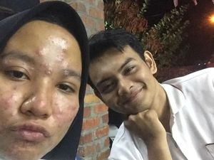Viral Pria Tulis Pesan Menyentuh Saat Wajah Pacarnya Jerawatan Parah
