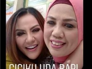 Potong Gigi Seperti Elly Sugigi Rawan Gagal, Ini Saran Dokter