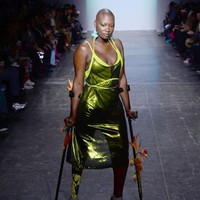 Menurut unggahan keluarga di Instagram pada Jumat (20/12/2019), model tanpa kaki tersebut mengembuskan napas terakhirnya pada Senin (16/12/2019) setelah seminggu berjuang di rumah sakit.  Foto: dok. Getty Images