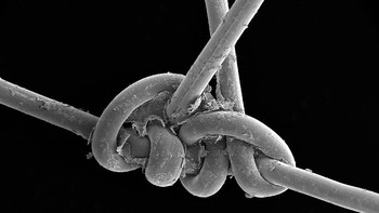 Foto benang bedah yang digunakan untuk menjahit luka kepala karya Anne Weston mendapatkan honourable mention di kategori pecitraan mikro. Gambar ditangkap menggunakan FEI Quanta scanning electron microscope. Foto: Royal Society Publishing Photography Competition