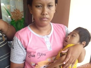 Kompleks, Bocah 7 Tahun Ini Kurang Gizi, Lumpuh dan Bibir Sumbing