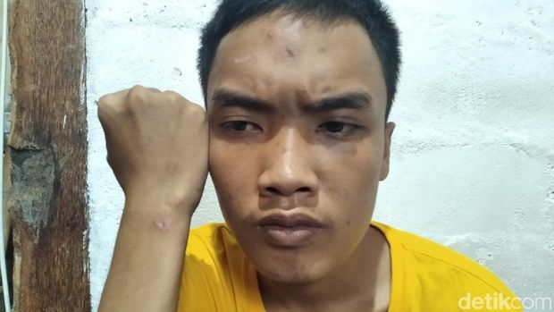 Ngaku Jadi Korban Salah Tangkap, Mahasiswa di Yogya Lapor ke Polda