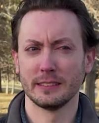 Pria Ini Nekat Pasang Implan Kunci Mobil di Tangannya