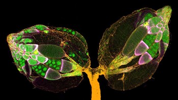  Sepasang ovarium milik lalat kecil Drosofila.  Karya Yujun Chen dan Dr Jocelyn McDonald. Foto: Nikon Small World 