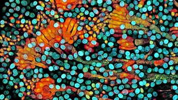 Spora penisilin. Karya Tagide de Carvalho. Foto: Nikon Small World 