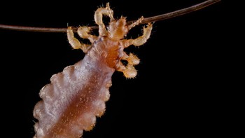 Kutu tergantung dirambut. Karya Walter Ferrari.  Foto: Nikon Small World 
