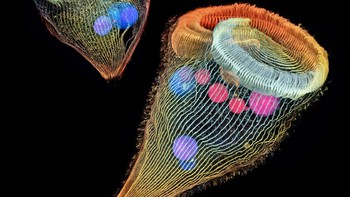 Protozoa air tawar sel tunggal, karya Dr Igor Siwanowicz. Foto: Nikon Small World