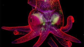 Emrio gurita. Karya Martyna Lukoseviciute dan Dr Carrie Albertin. Foto: Nikon Small World 