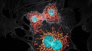 Sel BPAE dalam tahap mitosis. Karya Jason M Kirk. Foto: Nikon Small World 