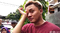 Rizky Febian sangat terpukul usai wafatnya Lina pada Sabtu (4/1), ia bahkan tak kuasa menahan tangis saat diwawancarai awak media. Dony Indra Ramadhan/detikcom
