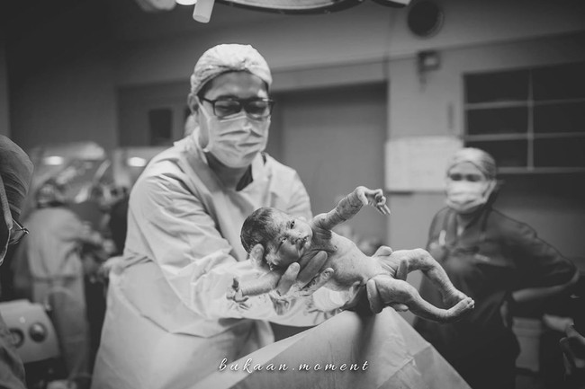 Anak kembar Syahnaz Sadiqah diberi nama Zunaira Alessia Safaraz dan Zayn Sadavir Ezhilan Ismail. Ini adalah Zunaira yang lahir berselang satu menit dari Zayn. Foto: Instagram @syahnazs