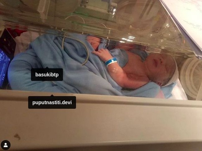 Putra Ahok dan Puput diberi nama Yosafat Abimanyu Purnama . Namanya merupakan perpaduan dari Alkitab dan bahasa Sansekerta. Jika ditelaah, nama anak Ahok-Puput bisa berarti raja yang berani, bertabiat baik dan memiliki sifat kepahlawanan. Foto: Instagram