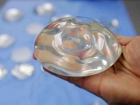 Ilustrasi implan payudara (AP Photo)