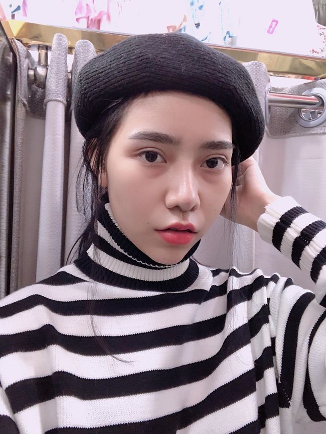 Seperti dikutip dari Asia One, wajah Tran berubah drastis hingga keluarga tak mengenalinya lagi. Sang ibu pun marah besar karena Tran operasi plastik tanpa minta izin padanya. Foto: Facebook/Tran Vu Van Anh