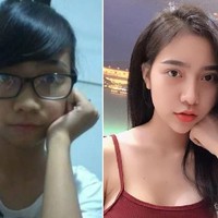 Tran Vu Van Anh operasi plastik pertama kali pada usia 19 tahun. Dari uang yang dikumpulkannya saat bekerja di dua tempat, Tran melakukan oplas untuk mengecilkan bentuk hidung yang menurutnya terlalu besar. Foto: Facebook/Tran Vu Van Anh