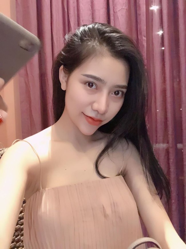 Satu bulan lamanya, ibu Tran menolak berbicara kepadanya, namun dirinya mengaku tak pernah menyesal pernah operasi plastik. Pada akhirnya sang ibu bisa menerima kondisi anaknya yang sudah mengubah wajah. Sekadar info, Tran datang dari keluarga konservatif yang menganggap operasi plastik adalah hal tabu. Foto: Facebook/Tran Vu Van Anh