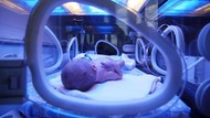 Heboh Bayi dari Hubungan Inses Meninggal 2 Jam Usai Lahir, Alami Kondisi Serius