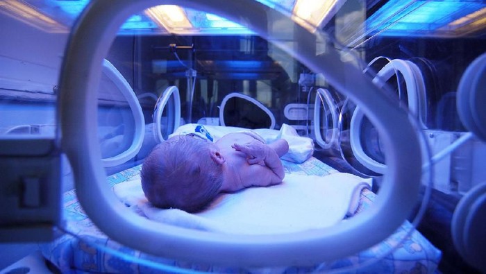 671365932 Newborn child baby having a treatment for jaundice under ultraviolet light in incubator. A neonatal intensive care unit (NICU), intensive care nursery (ICN) for premature newborn infants