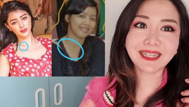 Ini Operasi Plastik yang Perlu Dilakukan Jika Ingin Secantik Siwi Sidi