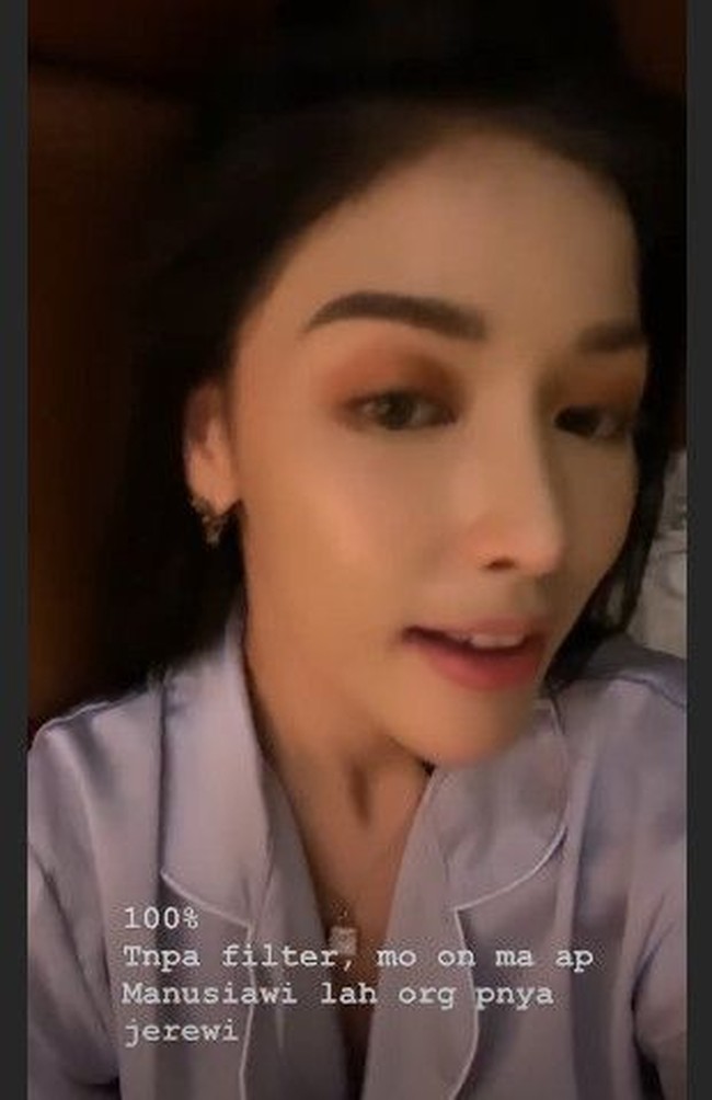 Heboh pemberitaan tentang wajahnya, Siwi Sidi pun curhat di Instagramnya @wid.hadi. Di awal video Instastory, Siwi mengatakan bahwa wajahnya tengah berjerawat. Siwi pun menegaskan bahwa di video tersebut dia tidak menggunakan filter editan foto. Aku tuh mau terangin ya, mohon maaf nih aku lagi breakout wajah aku. Ini tanpa filter ya, saudara-saudara, ucapnya.  Foto: dok. Instagram