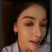 Heboh pemberitaan tentang wajahnya, Siwi Sidi pun curhat di Instagramnya @wid.hadi. Di awal video Instastory, Siwi mengatakan bahwa wajahnya tengah berjerawat. Siwi pun menegaskan bahwa di video tersebut dia tidak menggunakan filter editan foto. Aku tuh mau terangin ya, mohon maaf nih aku lagi breakout wajah aku. Ini tanpa filter ya, saudara-saudara, ucapnya.  Foto: dok. Instagram