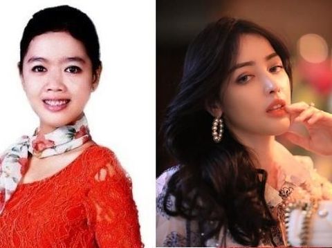 Siwi Sidi yang diduga operasi plastik